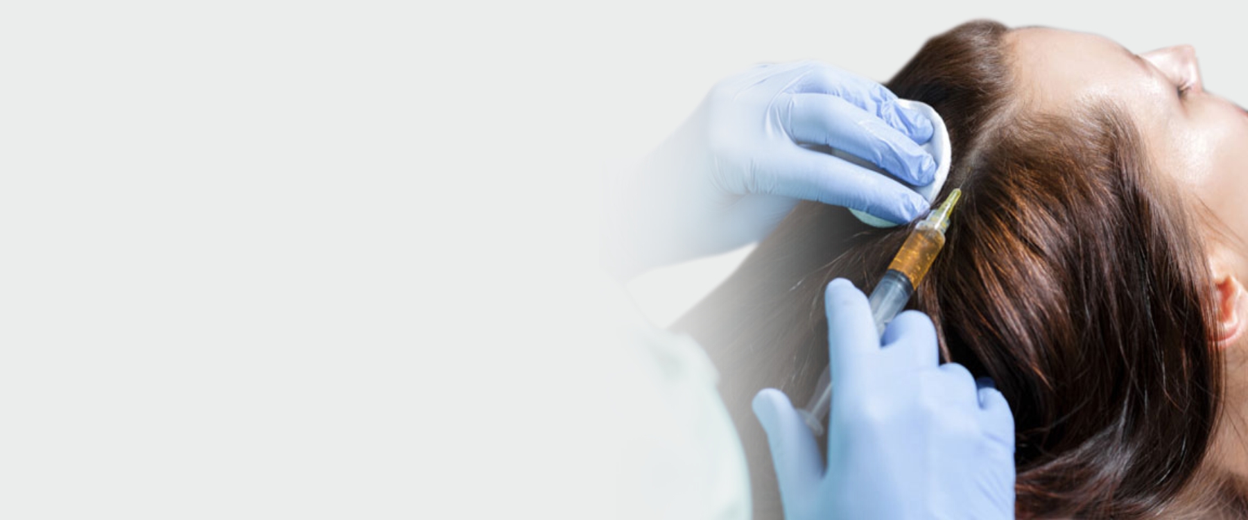 Hair Loss Treatment in Singapore